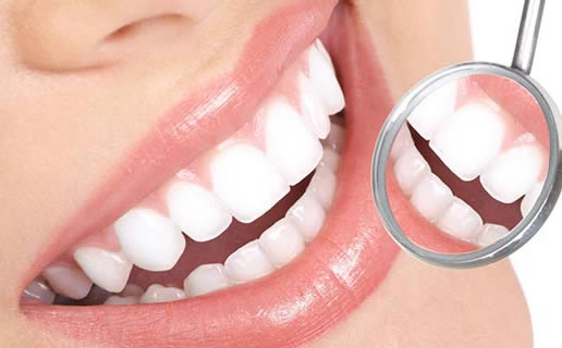 正畸出装有哪些注意事项?如何确保正畸效果最佳? 正畸出装有哪些注意事项?如何确保正畸效果最佳?