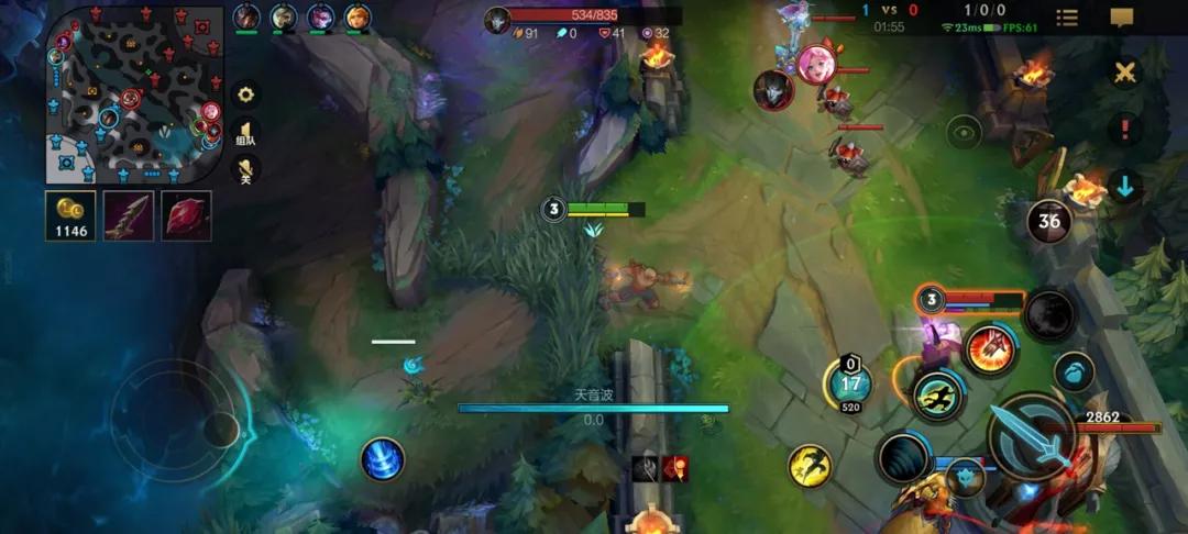 英雄联盟英雄出装攻略有哪些技巧？如何选择最佳装备？